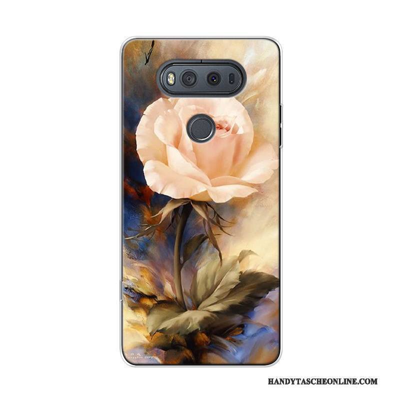 Hülle Lg V20 Weiche Kunst Hoch, Case Lg V20 Taschen Trend Sternenhimmel