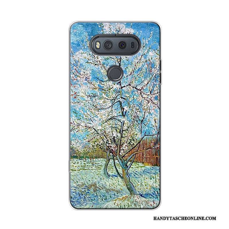 Hülle Lg V20 Weiche Kunst Hoch, Case Lg V20 Taschen Trend Sternenhimmel